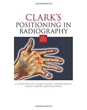 Clarks Positioning in Radiography