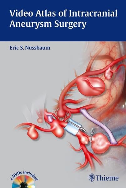 Video Atlas Of Intracranial Aneurysm Surgery,Used
