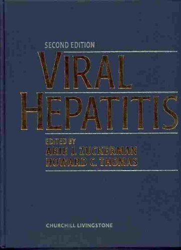 Viral Hepatitis,Used