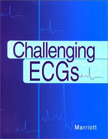 Challenging ECGs,Used
