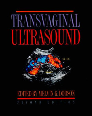 Transvaginal Ultrasound,Used