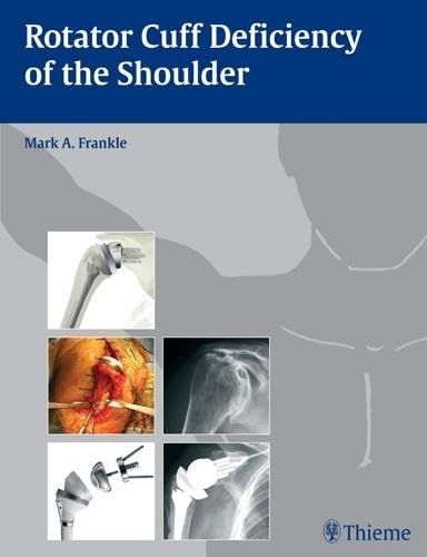 Rotator Cuff Deficiency Of The Shoulder