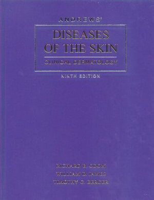 Andrews' Diseases of the Skin: Clinical Dermatology,Used