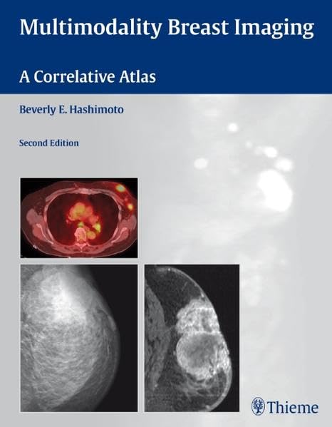 Multimodality Breast Imaging: A Correlative Atlas