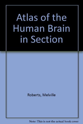 Atlas of the Human Brain in Section,Used