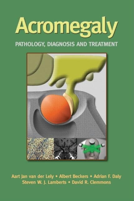 Acromegaly: Pathology, Diagnosis And Treatment,Used