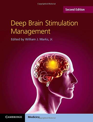 Deep Brain Stimulation Management,Used