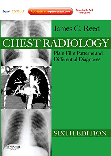 Chest Radiology: Plain Film Patterns and Differential Diagnoses, Expert Consult  Online and Print,Used