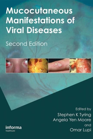 Mucocutaneous Manifestations of Viral Diseases: An Illustrated Guide to Diagnosis and Management,Used