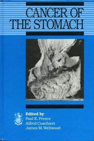Cancer of the Stomach,Used