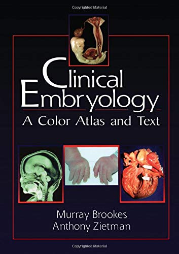 Clinical Embryology: A Color Atlas And Text,Used