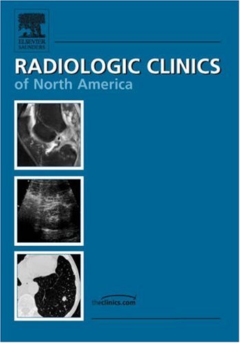 Neuroradiology Essentials, An Issue of Radiologic Clinics (The Clinics: Radiology) (Volume 441),Used