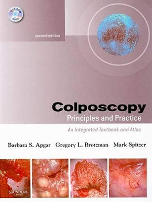 Colposcopy: Principles and Practice, Text with DVD