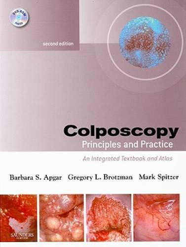 Colposcopy: Principles and Practice, Text with DVD
