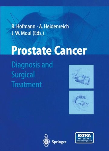 Prostate Cancer,Used
