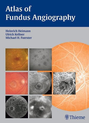 Atlas of Fundus Angiography,Used