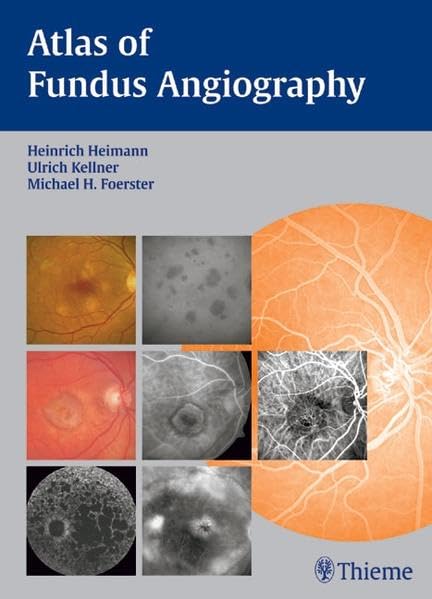 Atlas of Fundus Angiography,Used