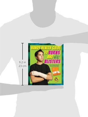 Handy Health Guide to Burns and Blisters (Handy Health Guides),Used