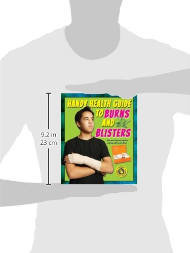 Handy Health Guide to Burns and Blisters (Handy Health Guides),Used