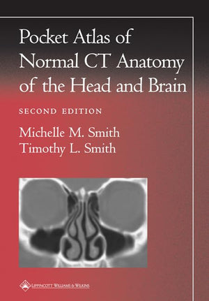 Pocket Atlas Of Normal Ct Anatomy Of The Head And Brain (Radiology Pocket Atlas Series),New