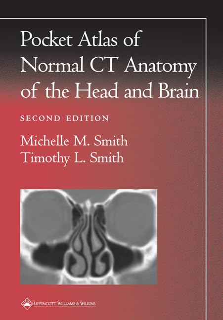 Pocket Atlas Of Normal Ct Anatomy Of The Head And Brain (Radiology Pocket Atlas Series),New