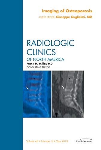 Imaging of Osteoporosis, An Issue of Radiologic Clinics of North America (Volume 483) (The Clinics: Radiology, Volume 483),Used