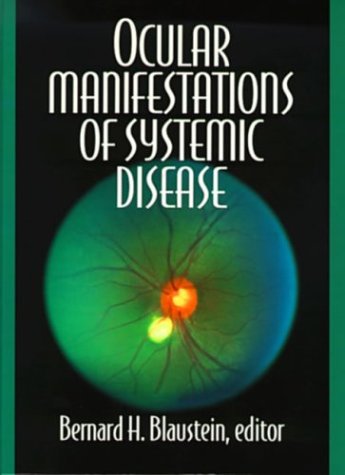 Ocular Manifestation,Used