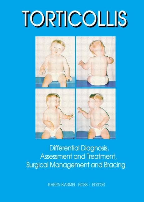 Torticollis : Differential Diagnosis, Assessment, and Treatment, Surgical Management and Bracing (for Pediatrics),Used