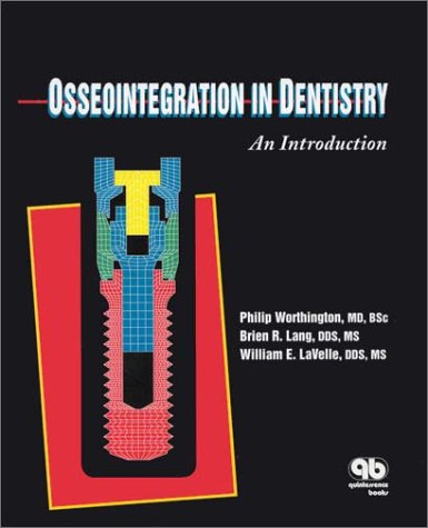 Osseointegration in Dentistry: An Introduction,Used