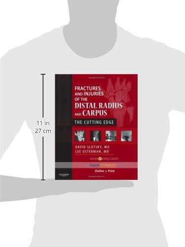 Fractures and Injuries of the Distal Radius and Carpus: The Cutting Edge  Expert Consult: Online and Print,Used