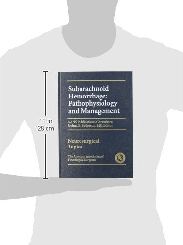 Subarachnoid Hemorrhage: Pathphysiology and Management,Used