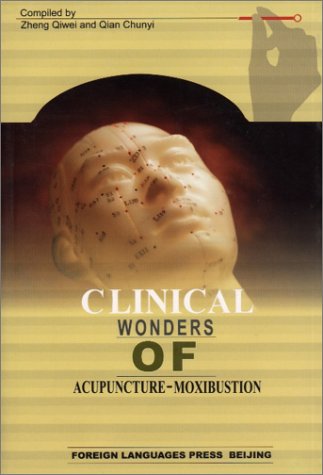 Clinical Wonders of AcupunctureMoxibustion,Used