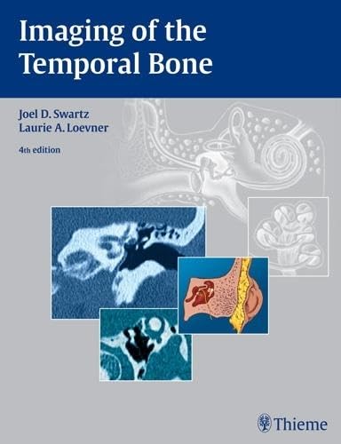 Imaging of the Temporal Bone,Used