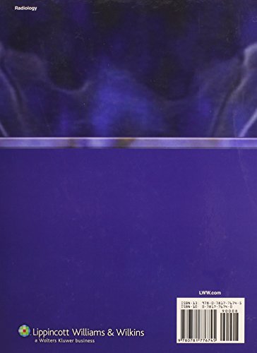 Molecular Anatomic Imaging: PETCT And SPECTCT Integrated Modality Imaging,Used
