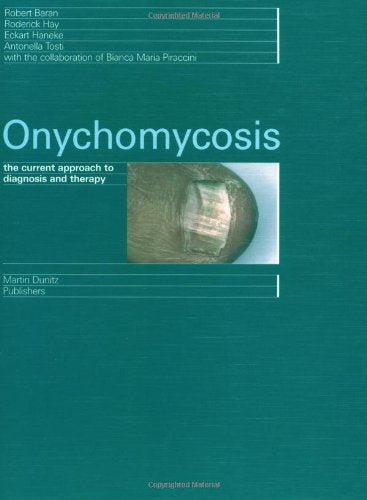 Onychomycosis: The Current Approach to Diagnosis and Therapy,Used