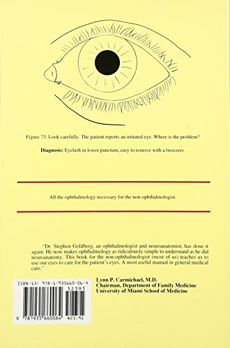 Ophthalmology Made Ridiculously Simple,Used