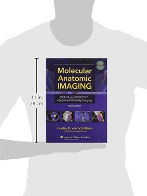 Molecular Anatomic Imaging: PETCT And SPECTCT Integrated Modality Imaging,Used