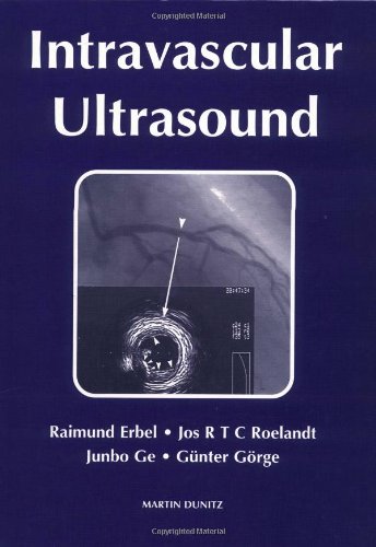 Intravascular Ultrasound,Used