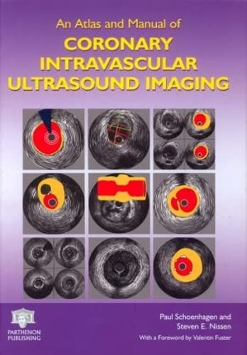 An Atlas And Manual Of Coronary Intravascular Ultrasound Imaging,Used