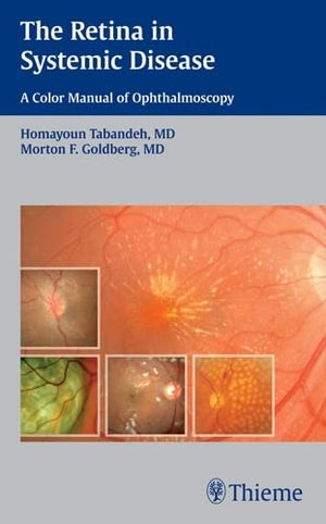 The Retina in Systemic Disease: A Color Manual of Ophthalmoscopy,New
