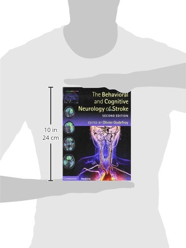The Behavioral and Cognitive Neurology of Stroke,Used