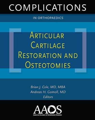 Articular Cartilage Restoration (Complications in Orthopaedics),Used