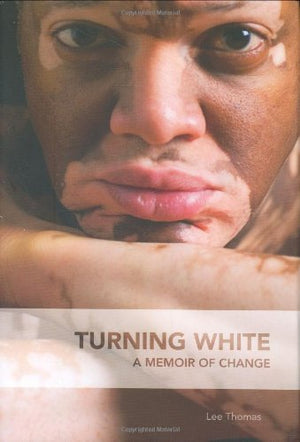 Turning White: A Memoir Of Change