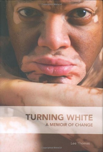 Turning White: A Memoir Of Change