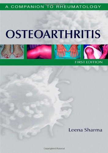 Osteoarthritis: A Companion To Rheumatology