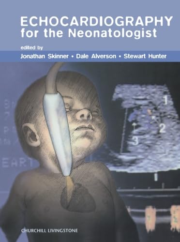 Echocardiography For The Neonatologist,Used