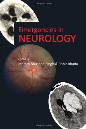 Emergencies in Neurology,Used