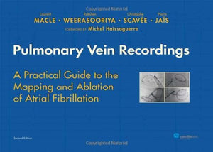 Pulmonary Vein Recordings: A Practical Guide To The Mapping And Ablation Of Atrial Fibrillation-new,New