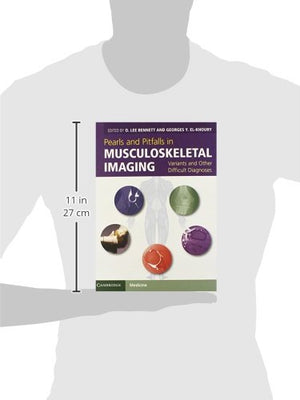 Pearls and Pitfalls in Musculoskeletal Imaging: Variants and Other Difficult Diagnoses,Used