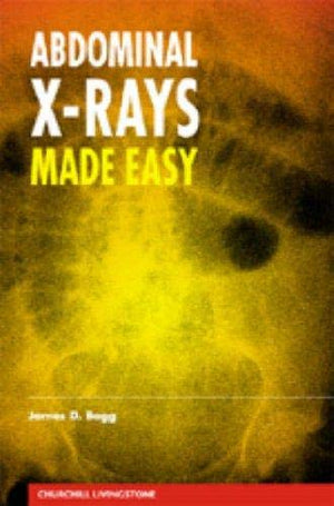 Abdominal XRays Made Easy,Used